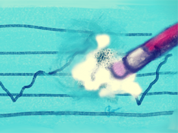 Litecoin Price Technical Analysis for 11/3/15: Corrections and Rebounds