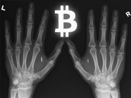 Bio-Implantable Bitcoin Wallets Becoming a Popular Storage Solution